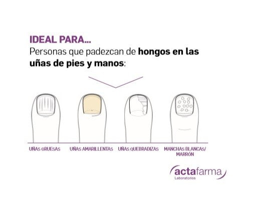 UNGEASIL Tratamiento Antihongos Uñas Manos y Pies 3.5ml